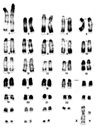 Caryotype de Chirogale de Milius (<em>Cheirogalus major</em>). Les chromosomes sont placés par comparaison avec le caryotype humain. Le Chirogale de Milius (ou grand Chirogale) est un Lémurien arboricole de Madagascar. Il pèse environ 300 grammes. Il se nourrit de fruits, de fleurs et d'insectes.<br />  Classification : Primates - Strepsirrhiniens - Lémuriformes [11931 views]