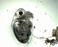 Cladocère (zooplancton permanent, crustacé). Femelle avec ses petits dans l'abdomen. Ce type de reproduction est particulier chez ces crustacés dont les femelles peuvent se reproduire par parthénogenèse dans certaines conditions. (M.O. X40)
 [6749 views]