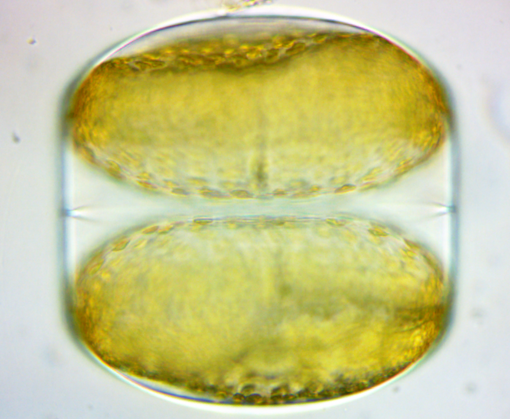 Diatomée centrale, <em>Coscinodiscus sp</em>. au MO x 400, deux cellules filles en vue équatoriale cingulaire – Disposition périodique des chloroplastes dans le plan des interférences lumineuses juste sous la membrane ce qui permet à la diatomée d’augmenter l’intensité lumineuse et donc sa photosynthèse. Cette microalgue dans une cage en verre transparente est donc une cellule photonique chlorophyllienne augmentée par rapport aux microalgues à paroi polysaccharidiques. <a href='https://phototheque.enseigne.ac-lyon.fr/photossql/photos.php?RollID=images&FrameID=Coscinodiscus1'>Vue polaire</a> – Vue équatoriale cingulaire.