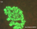 Ilot de Langerhans du pancréas (objectif x100, flurorescence). Certaines cellules des îlots apparaissent vert-jaune, ce sont les cellules contenant la protéine ciblée par l'anticorps couplé à la fluorescéine, à savoir l'insuline (cellules ß). Seul le cytoplasme est fluorescent, le noyau forme une tache noire. En effet, l'insuline a une localisation cytoplasmique.  Sur la <a href='https://phototheque.enseigne.ac-lyon.fr/photossql/photos.php?RollID=images&FrameID=LangerhansX100lum_blanche'>première photo (lumière blanche)</a>, le colorant de fond utilisé est le bleu d'Evans à la concentration finale de 0,1 %. Le bleu d'Evans colore la coupe en bleu, ce qui facilite le repérage des îlots de Langerhans à l'observation au microscope, mais limite également la fluorescence intrinsèque des tissus, ce qui favorise l'identification du signal. [26134 views]