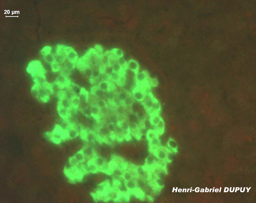 Ilot de Langerhans du pancréas (objectif x100, flurorescence). Certaines cellules des îlots apparaissent vert-jaune, ce sont les cellules contenant la protéine ciblée par l'anticorps couplé à la fluorescéine, à savoir l'insuline (cellules ß). Seul le cytoplasme est fluorescent, le noyau forme une tache noire. En effet, l'insuline a une localisation cytoplasmique.  Sur la <a href='https://phototheque.enseigne.ac-lyon.fr/photossql/photos.php?RollID=images&FrameID=LangerhansX100lum_blanche'>première photo (lumière blanche)</a>, le colorant de fond utilisé est le bleu d'Evans à la concentration finale de 0,1 %. Le bleu d'Evans colore la coupe en bleu, ce qui facilite le repérage des îlots de Langerhans à l'observation au microscope, mais limite également la fluorescence intrinsèque des tissus, ce qui favorise l'identification du signal.