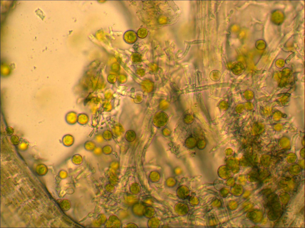 Préparation microscopique de lichen montrant l'association entre le mycobionte hétérotrophe (hyphes du champignon) et le photobionte autotrophe (ici une algue verte). Grossissement x400.