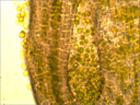 Préparation microscopique de lichen montrant l'association entre le mycobionte hétérotrophe (hyphes du champignon) et le photobionte autotrophe (ici une algue verte). Grossissement x400.
 
 [25717 views]