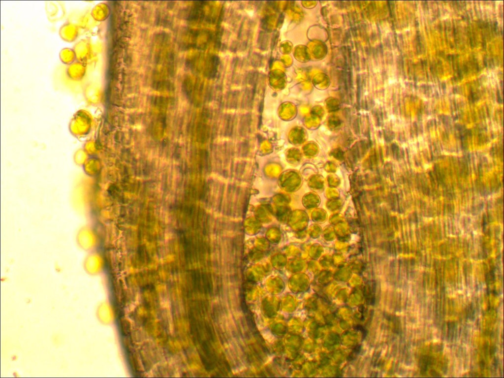 Préparation microscopique de lichen montrant l'association entre le mycobionte hétérotrophe (hyphes du champignon) et le photobionte autotrophe (ici une algue verte). Grossissement x400.
 
