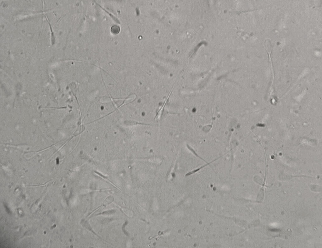 Spermatozoïdes de taureau observés au microscope optique. Les spermatozoïdes proviennent de paillettes de sperme produites dans un centre d'insémination artificielle. Les paillettes sont extraites de l'azote liquide et décongelées dans de l'eau à 36°C, avant observation des spermatozoïdes vivants.
<a href='http://svt.enseigne.ac-lyon.fr/spip/spip.php?article497'>Page liée</a>.