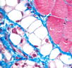 Tissus structuraux (objectif x100) : cette coupe nous montre différents types de tissus structuraux classiques. En bleu, des fibres de collagène, matériel extra-cellulaire produit par les fibroblastes (ou cellules du tissu conjonctif) dont seuls les noyaux sont visibles. De grandes cellules vides, limitées par une membrane et dont les noyaux sont repoussés à la périphérie : ce sont des adipocytes ou cellules du tissu adipeux (ou tissu graisseux) : le contenu lipidique a été dissous au cours du traitement chimique nécessaire à la réalisation de la coupe.  A droite du document, coloré en rouge, se trouve du tissu musculaire en section transversale : on distingue plusieurs faisceaux de fibres musculaires, entourés d'une couche de collagène plus ou moins épaisse, et quelques noyaux de cellules musculaires.  <br />Coloration trichromique de Masson modifiée : le bleu d'aniline  acétique (qui colore le collagène), remplace le vert lumière.  Les noyaux des cellules sont colorées par l'Hématoxyline de Groat, les  cytoplasmes par un mélange de fuchine acide, ponceau de xylidine, et  donc bleu d'aniline acétique. [26377 views]
