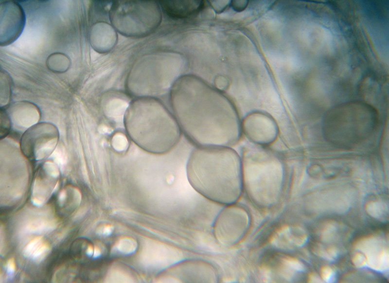 Les cellules du tubercule de <a href='https://phototheque.enseigne.ac-lyon.fr/photossql/photos.php?RollID=images&FrameID=pomme_terre'>pomme de terre</a> montrent la présence de très nombreux grains d'amidon (amyloplastes) de taille variable. Coupe faite à main levée, montage dans de l'eau.