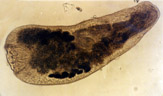 Ver plat (plathelminthe) du genre <em>Bucephalopsis</em>. C'est un trématode parasite des poissons, avec des mollusques comme hôtes intermédiaires. Il s'attache à son hôte à l'aide d'une ventouse musculeuse. Le tube digestif ne comprend qu'une seule ouverture ventrale, qui joue le rôle de bouche et d'anus. [2892 views]
