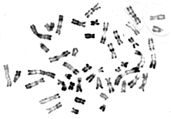 Le caryotype est une technique qui permet l'étude des chromosomes d'un individu.  Tout prélèvement dont les cellules sont en division <em>in vitro</em> permet l'établissement d'un caryotype (lymphocytes T du sang, fibroblastes de la peau, cellules du liquide amniotique, ...). 
Les cellules en multiplication sont traitées avec de la colchicine qui empêche la polymérisation de la tubuline et donc la formation du fuseau mitotique. La mitose est alors bloquée au stade de métaphase. Les cellules subissent ensuite un choc hypotonique qui fragilise les membranes, puis les constituants cellulaires sont fixés grâce à un fixateur. On laisse alors tomber quelques gouttes de la  suspension de cellules sur une lame de verre ce qui fait éclater les membranes, et libère ainsi les chromosomes qui restent toutefois groupés. Diverses techniques de coloration permettent ensuite d'observer les chromosomes en microscopie optique. Classiquement on réalise ensuite une micro-photographie d'un ensemble chromosomique en vérifiant qu'aucun chromosome ne recouvre son voisin (recherche microscopique de la meilleure disposition). Cette photographie, agrandie sur papier, est découpée, manuellement, afin de trier les chromosomes. C'est l'ensemble, trié, numéroté qui est photographié à nouveau et qui constitue le caryotype présenté.<br />
Caryotype <strong>XX</strong> : <strong>groupe de chromosomes</strong> - <strong><a href='https://phototheque.enseigne.ac-lyon.fr/photossql/photos.php?RollID=images&FrameID=caryotypeXX_trie'>chromosomes triés</a></strong><br /> 
Caryotype <strong>XY</strong> : <strong><a href='https://phototheque.enseigne.ac-lyon.fr/photossql/photos.php?RollID=images&FrameID=caryotypeXY_non-trie'>groupe de chromosomes</a></strong> - <strong><a href='https://phototheque.enseigne.ac-lyon.fr/photossql/photos.php?RollID=images&FrameID=caryotypeXY_trie'>chromosomes triés</a></strong>
