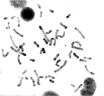Le caryotype est une technique qui permet l'étude des chromosomes d'un individu.  Tout prélèvement dont les cellules sont en division <em>in vitro</em> permet l'établissement d'un caryotype (lymphocytes T du sang, fibroblastes de la peau, cellules du liquide amniotique, ...). 
Les cellules en multiplication sont traitées avec de la colchicine qui empêche la polymérisation de la tubuline et donc la formation du fuseau mitotique. La mitose est alors bloquée au stade de métaphase. Les cellules subissent ensuite un choc hypotonique qui fragilise les membranes, puis les constituants cellulaires sont fixés grâce à un fixateur. On laisse alors tomber quelques gouttes de la  suspension de cellules sur une lame de verre ce qui fait éclater les membranes, et libère ainsi les chromosomes qui restent toutefois groupés. Diverses techniques de coloration permettent ensuite d'observer les chromosomes en microscopie optique. Classiquement on réalise ensuite une micro-photographie d'un ensemble chromosomique en vérifiant qu'aucun chromosome ne recouvre son voisin (recherche microscopique de la meilleure disposition). Cette photographie, agrandie sur papier, est découpée, manuellement, afin de trier les chromosomes. C'est l'ensemble, trié, numéroté qui est photographié à nouveau et qui constitue le caryotype présenté.<br />
Caryotype <strong>XX</strong> : <strong><a href='https://phototheque.enseigne.ac-lyon.fr/photossql/photos.php?RollID=images&FrameID=caryotypeXX_non-trie'>groupe de chromosomes</a></strong> - <strong><a href='https://phototheque.enseigne.ac-lyon.fr/photossql/photos.php?RollID=images&FrameID=caryotypeXX_trie'>chromosomes triés</a></strong><br /> 
Caryotype <strong>XY</strong> : <strong>groupe de chromosomes</strong> - <strong><a href='https://phototheque.enseigne.ac-lyon.fr/photossql/photos.php?RollID=images&FrameID=caryotypeXY_trie'>chromosomes triés</a></strong> [23021 views]