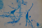 Cellules nerveuses de moëlle épinière, dissociées. [26619 views]