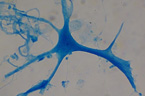 Cellules nerveuses de moëlle épinière, dissociées. [7765 views]