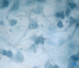 Observation microscopique de frottis de cortex cérébral de veau (grossissement x400).    Coloration bleu de méthylène.  Photo réalisée par des élèves de 1èreS1 du lycée Michelet de Montauban [29352 views]