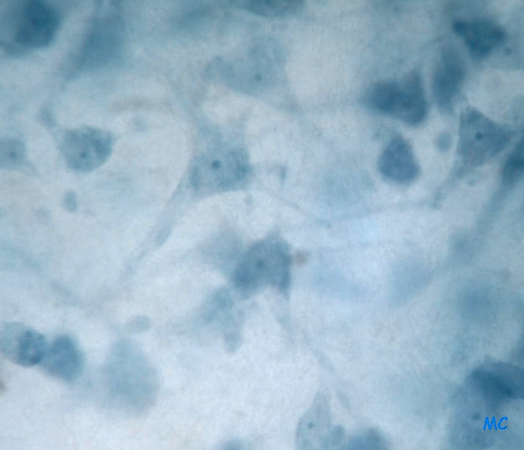 Observation microscopique de frottis de cortex cérébral de veau (grossissement x400).    Coloration bleu de méthylène.  Photo réalisée par des élèves de 1èreS1 du lycée Michelet de Montauban