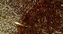 Coupe transversale de moelle épinière observée au microscope optique. [40928 views]