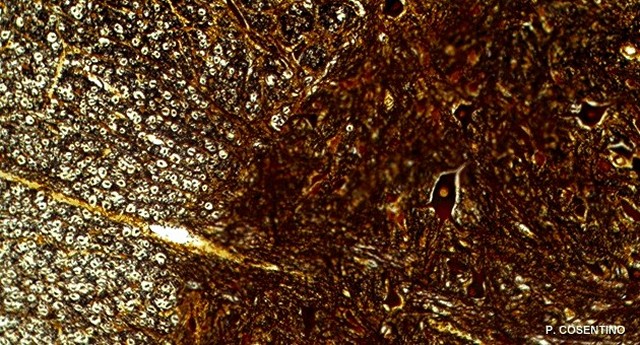 Coupe transversale de moelle épinière observée au microscope optique.