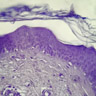 Coupe transversale de peau humaine (x640). La peau est constituée de 3 couches de la surface vers la profondeur : l'épiderme, le derme et l'hypoderme. Ici l'épiderme est constitué des cellules les plus colorées en haut de l'image (principalement des kératinocytes), depuis la couche basale où les cellules souches renouvellent l'épiderme en 6 semaines, jusqu'à la couche cornée qui se desquame en lamelles. Le derme apparaît plus clair sous l'épiderme : c'est un tissu conjonctif riche en fibres. Il contient des vaisseaux sanguins et lymphatiques, des nerfs et des terminaisons nerveuses sensitives. [8981 views]