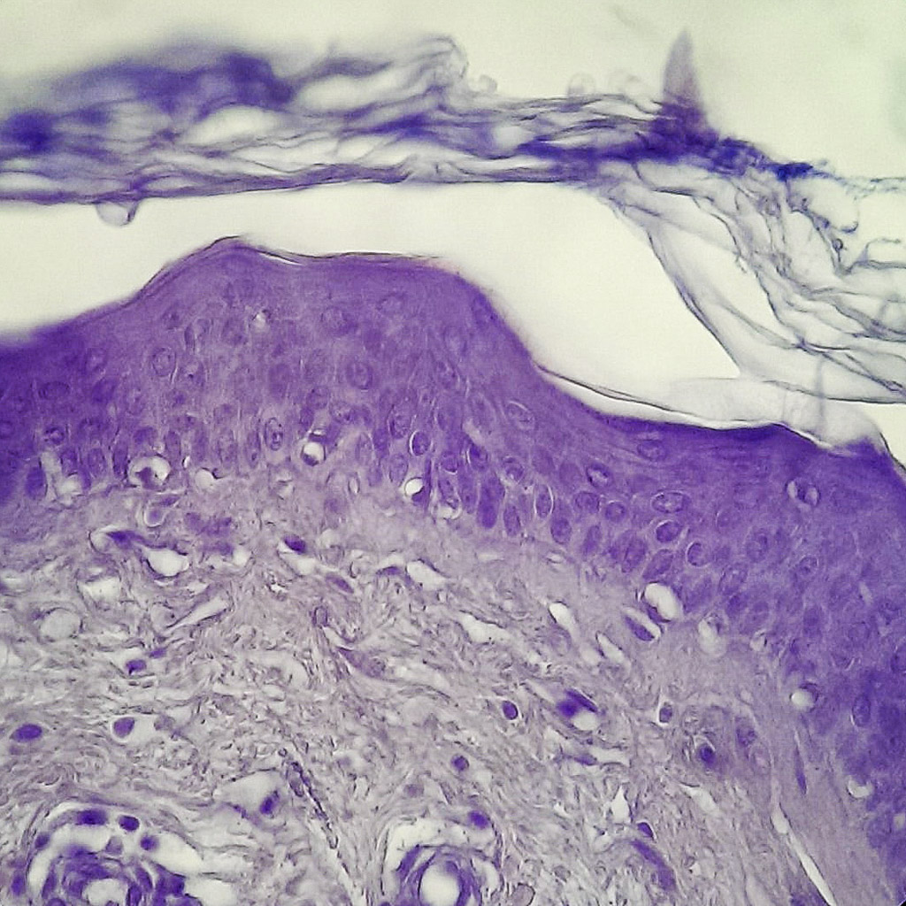 Coupe transversale de peau humaine (x640). La peau est constituée de 3 couches de la surface vers la profondeur : l'épiderme, le derme et l'hypoderme. Ici l'épiderme est constitué des cellules les plus colorées en haut de l'image (principalement des kératinocytes), depuis la couche basale où les cellules souches renouvellent l'épiderme en 6 semaines, jusqu'à la couche cornée qui se desquame en lamelles. Le derme apparaît plus clair sous l'épiderme : c'est un tissu conjonctif riche en fibres. Il contient des vaisseaux sanguins et lymphatiques, des nerfs et des terminaisons nerveuses sensitives.