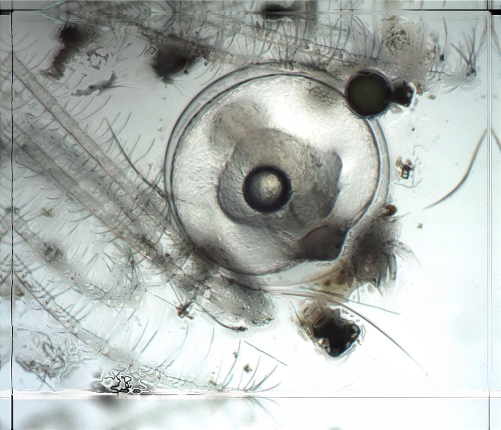 Zooplancton : embryon de poisson, faisant partie du zooplancton temporaire. Cet embryon de poisson est prisonnier d'une exuvie de balane adulte, ce qui nous permet d'évaluer sa taille (diamètre de 1 mm environ). On observe nettement la gouttelette d'huile lui permettant de flotter entre deux eaux. Photo prise au microscope (X 10) et retravaillée avec le logiciel combineZP.
