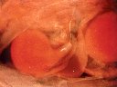Fécondation du colza (<em>Brassica napus</em>) : les tubes polliniques, véhiculant les gamètes mâles, pénètrent dans le tissu de transmission du style, jusqu'à la cavité ovarienne de la fleur d'angiosperme. Ici un tube pollinique révélé par épifluorescence (en blanc), longe la cavité ovarienne puis le funicule et féconde l'ovule anatrope (en rouge). [30379 views]