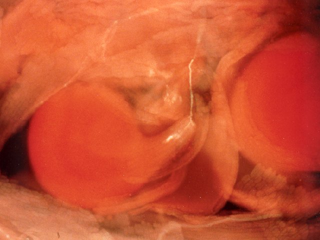 Fécondation du colza (<em>Brassica napus</em>) : les tubes polliniques, véhiculant les gamètes mâles, pénètrent dans le tissu de transmission du style, jusqu'à la cavité ovarienne de la fleur d'angiosperme. Ici un tube pollinique révélé par épifluorescence (en blanc), longe la cavité ovarienne puis le funicule et féconde l'ovule anatrope (en rouge).
