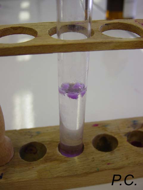 ADN d'oignon, coloration de Feulgen.