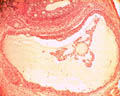 Follicule de de Graaf (ovaire de lapine, microscope X100). Dans l'ovaire chaque ovocyte est entouré d'une enveloppe cellulaire plus ou moins développée, l'ensemble formant un follicule ovarien. Les <a href='https://phototheque.enseigne.ac-lyon.fr/photossql/photos.php?RollID=images&FrameID=follicules_primordiaux'><strong>follicules primordiaux</strong></a> sont constitués durant la période fœtale : une vingtaine de cellules aplaties entoure l'ovocyte. A partir de la puberté et à chaque cycle un certain nombre de follicules primordiaux se développent en <a href='https://phototheque.enseigne.ac-lyon.fr/photossql/photos.php?RollID=images&FrameID=follicule_primaire'><strong>follicules primaires</strong></a> : l'ovocyte grossit très légèrement et les cellules aplaties évoluent pour former des cellules cubiques, mais ne forment toujours qu'une seule couche. Dans le <a href='https://phototheque.enseigne.ac-lyon.fr/photossql/photos.php?RollID=images&FrameID=follicule_secondaire'><strong>follicule secondaire</strong></a>, l'ovocyte est entouré de plusieurs couches de cellules (voir aussi : <a href='https://phototheque.enseigne.ac-lyon.fr/photossql/photos.php?RollID=images&FrameID=follicules_primaire_et_secondaire'><strong>follicules primaire et secondaires côte à côte</strong></a>). Ensuite les cellules folliculaires entourant l'ovocyte deviennent cubiques, volumineuses et granuleuses : elles forment plusieurs couches cellulaires appelées granulosa. La granulosa se creuse de cavités remplies de liquide : c'est le stade <a href='https://phototheque.enseigne.ac-lyon.fr/photossql/photos.php?RollID=images&FrameID=follicule_cavitaire'><strong>follicule cavitaire</strong></a>. Le follicule mûr, ou <a href='https://phototheque.enseigne.ac-lyon.fr/photossql/photos.php?RollID=images&FrameID=follicule_De_Graaf'><strong>follicule de de Graaf</strong></a> est prêt à expulser l'ovocyte et les cellules qui l'entourent (la corona radiata).  [11535 views]