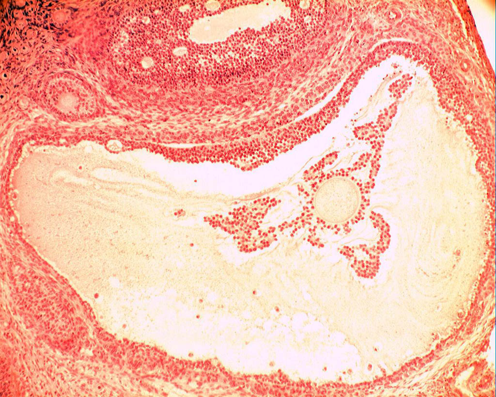 Follicule de de Graaf (ovaire de lapine, microscope X100). Dans l'ovaire chaque ovocyte est entouré d'une enveloppe cellulaire plus ou moins développée, l'ensemble formant un follicule ovarien. Les <a href='https://phototheque.enseigne.ac-lyon.fr/photossql/photos.php?RollID=images&FrameID=follicules_primordiaux'><strong>follicules primordiaux</strong></a> sont constitués durant la période fœtale : une vingtaine de cellules aplaties entoure l'ovocyte. A partir de la puberté et à chaque cycle un certain nombre de follicules primordiaux se développent en <a href='https://phototheque.enseigne.ac-lyon.fr/photossql/photos.php?RollID=images&FrameID=follicule_primaire'><strong>follicules primaires</strong></a> : l'ovocyte grossit très légèrement et les cellules aplaties évoluent pour former des cellules cubiques, mais ne forment toujours qu'une seule couche. Dans le <a href='https://phototheque.enseigne.ac-lyon.fr/photossql/photos.php?RollID=images&FrameID=follicule_secondaire'><strong>follicule secondaire</strong></a>, l'ovocyte est entouré de plusieurs couches de cellules (voir aussi : <a href='https://phototheque.enseigne.ac-lyon.fr/photossql/photos.php?RollID=images&FrameID=follicules_primaire_et_secondaire'><strong>follicules primaire et secondaires côte à côte</strong></a>). Ensuite les cellules folliculaires entourant l'ovocyte deviennent cubiques, volumineuses et granuleuses : elles forment plusieurs couches cellulaires appelées granulosa. La granulosa se creuse de cavités remplies de liquide : c'est le stade <a href='https://phototheque.enseigne.ac-lyon.fr/photossql/photos.php?RollID=images&FrameID=follicule_cavitaire'><strong>follicule cavitaire</strong></a>. Le follicule mûr, ou <a href='https://phototheque.enseigne.ac-lyon.fr/photossql/photos.php?RollID=images&FrameID=follicule_De_Graaf'><strong>follicule de de Graaf</strong></a> est prêt à expulser l'ovocyte et les cellules qui l'entourent (la corona radiata). 