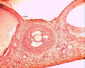 Follicule cavitaire (ovaire de lapine, microscope X400). Dans l'ovaire chaque ovocyte est entouré d'une enveloppe cellulaire plus ou moins développée, l'ensemble formant un follicule ovarien. Les <a href='https://phototheque.enseigne.ac-lyon.fr/photossql/photos.php?RollID=images&FrameID=follicules_primordiaux'><strong>follicules primordiaux</strong></a> sont constitués durant la période fœtale : une vingtaine de cellules aplaties entoure l'ovocyte. A partir de la puberté et à chaque cycle un certain nombre de follicules primordiaux se développent en <a href='https://phototheque.enseigne.ac-lyon.fr/photossql/photos.php?RollID=images&FrameID=follicule_primaire'><strong>follicules primaires</strong></a> : l'ovocyte grossit très légèrement et les cellules aplaties évoluent pour former des cellules cubiques, mais ne forment toujours qu'une seule couche. Dans le <a href='https://phototheque.enseigne.ac-lyon.fr/photossql/photos.php?RollID=images&FrameID=follicule_secondaire'><strong>follicule secondaire</strong></a>, l'ovocyte est entouré de plusieurs couches de cellules (voir aussi : <a href='https://phototheque.enseigne.ac-lyon.fr/photossql/photos.php?RollID=images&FrameID=follicules_primaire_et_secondaire'><strong>follicules primaire et secondaires côte à côte</strong></a>). Ensuite les cellules folliculaires entourant l'ovocyte deviennent cubiques, volumineuses et granuleuses : elles forment plusieurs couches cellulaires appelées granulosa. La granulosa se creuse de cavités remplies de liquide : c'est le stade <a href='https://phototheque.enseigne.ac-lyon.fr/photossql/photos.php?RollID=images&FrameID=follicule_cavitaire'><strong>follicule cavitaire</strong></a>. Le follicule mûr, ou <a href='https://phototheque.enseigne.ac-lyon.fr/photossql/photos.php?RollID=images&FrameID=follicule_De_Graaf'><strong>follicule de de Graaf</strong></a> est prêt à expulser l'ovocyte et les cellules qui l'entourent (la corona radiata).  [20503 views]