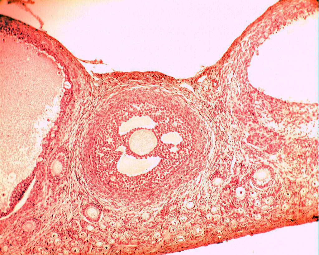 Follicule cavitaire (ovaire de lapine, microscope X400). Dans l'ovaire chaque ovocyte est entouré d'une enveloppe cellulaire plus ou moins développée, l'ensemble formant un follicule ovarien. Les <a href='https://phototheque.enseigne.ac-lyon.fr/photossql/photos.php?RollID=images&FrameID=follicules_primordiaux'><strong>follicules primordiaux</strong></a> sont constitués durant la période fœtale : une vingtaine de cellules aplaties entoure l'ovocyte. A partir de la puberté et à chaque cycle un certain nombre de follicules primordiaux se développent en <a href='https://phototheque.enseigne.ac-lyon.fr/photossql/photos.php?RollID=images&FrameID=follicule_primaire'><strong>follicules primaires</strong></a> : l'ovocyte grossit très légèrement et les cellules aplaties évoluent pour former des cellules cubiques, mais ne forment toujours qu'une seule couche. Dans le <a href='https://phototheque.enseigne.ac-lyon.fr/photossql/photos.php?RollID=images&FrameID=follicule_secondaire'><strong>follicule secondaire</strong></a>, l'ovocyte est entouré de plusieurs couches de cellules (voir aussi : <a href='https://phototheque.enseigne.ac-lyon.fr/photossql/photos.php?RollID=images&FrameID=follicules_primaire_et_secondaire'><strong>follicules primaire et secondaires côte à côte</strong></a>). Ensuite les cellules folliculaires entourant l'ovocyte deviennent cubiques, volumineuses et granuleuses : elles forment plusieurs couches cellulaires appelées granulosa. La granulosa se creuse de cavités remplies de liquide : c'est le stade <a href='https://phototheque.enseigne.ac-lyon.fr/photossql/photos.php?RollID=images&FrameID=follicule_cavitaire'><strong>follicule cavitaire</strong></a>. Le follicule mûr, ou <a href='https://phototheque.enseigne.ac-lyon.fr/photossql/photos.php?RollID=images&FrameID=follicule_De_Graaf'><strong>follicule de de Graaf</strong></a> est prêt à expulser l'ovocyte et les cellules qui l'entourent (la corona radiata). 
