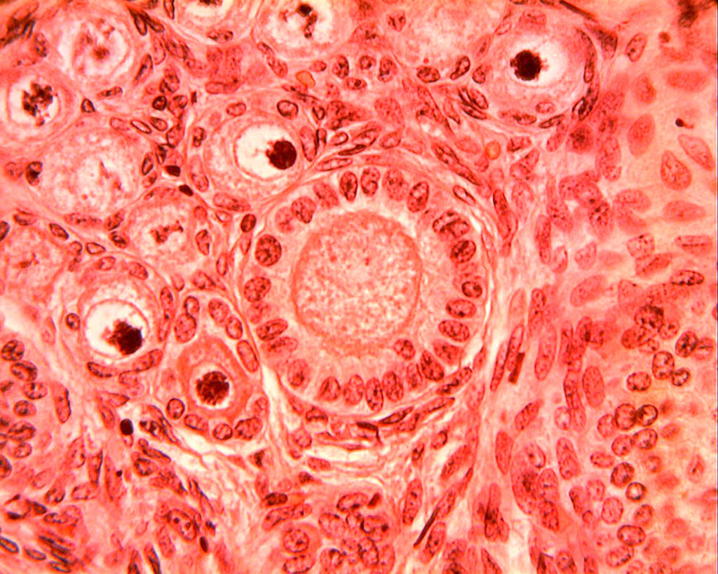 Follicule primaire (ovaire de lapine, microscope X600). Dans l'ovaire chaque ovocyte est entouré d'une enveloppe cellulaire plus ou moins développée, l'ensemble formant un follicule ovarien. Les <a href='https://phototheque.enseigne.ac-lyon.fr/photossql/photos.php?RollID=images&FrameID=follicules_primordiaux'><strong>follicules primordiaux</strong></a> sont constitués durant la période fœtale : une vingtaine de cellules aplaties entoure l'ovocyte. A partir de la puberté et à chaque cycle un certain nombre de follicules primordiaux se développent en <a href='https://phototheque.enseigne.ac-lyon.fr/photossql/photos.php?RollID=images&FrameID=follicule_primaire'><strong>follicules primaires</strong></a> : l'ovocyte grossit très légèrement et les cellules aplaties évoluent pour former des cellules cubiques, mais ne forment toujours qu'une seule couche. Dans le <a href='https://phototheque.enseigne.ac-lyon.fr/photossql/photos.php?RollID=images&FrameID=follicule_secondaire'><strong>follicule secondaire</strong></a>, l'ovocyte est entouré de plusieurs couches de cellules (voir aussi : <a href='https://phototheque.enseigne.ac-lyon.fr/photossql/photos.php?RollID=images&FrameID=follicules_primaire_et_secondaire'><strong>follicules primaire et secondaires côte à côte</strong></a>). Ensuite les cellules folliculaires entourant l'ovocyte deviennent cubiques, volumineuses et granuleuses : elles forment plusieurs couches cellulaires appelées granulosa. La granulosa se creuse de cavités remplies de liquide : c'est le stade <a href='https://phototheque.enseigne.ac-lyon.fr/photossql/photos.php?RollID=images&FrameID=follicule_cavitaire'><strong>follicule cavitaire</strong></a>. Le follicule mûr, ou <a href='https://phototheque.enseigne.ac-lyon.fr/photossql/photos.php?RollID=images&FrameID=follicule_De_Graaf'><strong>follicule de de Graaf</strong></a> est prêt à expulser l'ovocyte et les cellules qui l'entourent (la corona radiata). 