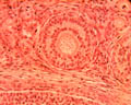 Follicule secondaire (ovaire de lapine, microscope X600). Dans l'ovaire chaque ovocyte est entouré d'une enveloppe cellulaire plus ou moins développée, l'ensemble formant un follicule ovarien. Les <a href='https://phototheque.enseigne.ac-lyon.fr/photossql/photos.php?RollID=images&FrameID=follicules_primordiaux'><strong>follicules primordiaux</strong></a> sont constitués durant la période fœtale : une vingtaine de cellules aplaties entoure l'ovocyte. A partir de la puberté et à chaque cycle un certain nombre de follicules primordiaux se développent en <a href='https://phototheque.enseigne.ac-lyon.fr/photossql/photos.php?RollID=images&FrameID=follicule_primaire'><strong>follicules primaires</strong></a> : l'ovocyte grossit très légèrement et les cellules aplaties évoluent pour former des cellules cubiques, mais ne forment toujours qu'une seule couche. Dans le <a href='https://phototheque.enseigne.ac-lyon.fr/photossql/photos.php?RollID=images&FrameID=follicule_secondaire'><strong>follicule secondaire</strong></a>, l'ovocyte est entouré de plusieurs couches de cellules (voir aussi : <a href='https://phototheque.enseigne.ac-lyon.fr/photossql/photos.php?RollID=images&FrameID=follicules_primaire_et_secondaire'><strong>follicules primaire et secondaires côte à côte</strong></a>). Ensuite les cellules folliculaires entourant l'ovocyte deviennent cubiques, volumineuses et granuleuses : elles forment plusieurs couches cellulaires appelées granulosa. La granulosa se creuse de cavités remplies de liquide : c'est le stade <a href='https://phototheque.enseigne.ac-lyon.fr/photossql/photos.php?RollID=images&FrameID=follicule_cavitaire'><strong>follicule cavitaire</strong></a>. Le follicule mûr, ou <a href='https://phototheque.enseigne.ac-lyon.fr/photossql/photos.php?RollID=images&FrameID=follicule_De_Graaf'><strong>follicule de de Graaf</strong></a> est prêt à expulser l'ovocyte et les cellules qui l'entourent (la corona radiata).  [11197 views]