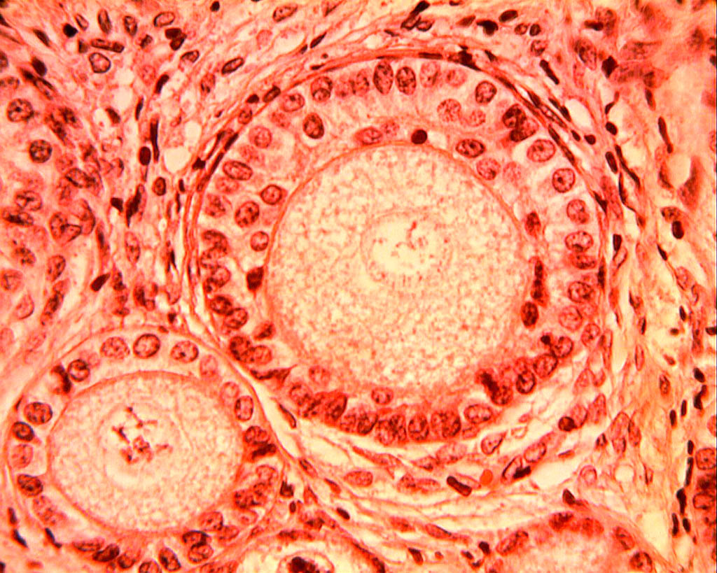Follicules primaires et secondaires (ovaire de lapine, microscope X600). Dans l'ovaire chaque ovocyte est entouré d'une enveloppe cellulaire plus ou moins développée, l'ensemble formant un follicule ovarien. Les <a href='https://phototheque.enseigne.ac-lyon.fr/photossql/photos.php?RollID=images&FrameID=follicules_primordiaux'><strong>follicules primordiaux</strong></a> sont constitués durant la période fœtale : une vingtaine de cellules aplaties entoure l'ovocyte. A partir de la puberté et à chaque cycle un certain nombre de follicules primordiaux se développent en <a href='https://phototheque.enseigne.ac-lyon.fr/photossql/photos.php?RollID=images&FrameID=follicule_primaire'><strong>follicules primaires</strong></a> : l'ovocyte grossit très légèrement et les cellules aplaties évoluent pour former des cellules cubiques, mais ne forment toujours qu'une seule couche. Dans le <a href='https://phototheque.enseigne.ac-lyon.fr/photossql/photos.php?RollID=images&FrameID=follicule_secondaire'><strong>follicule secondaire</strong></a>, l'ovocyte est entouré de plusieurs couches de cellules (voir aussi : <a href='https://phototheque.enseigne.ac-lyon.fr/photossql/photos.php?RollID=images&FrameID=follicules_primaire_et_secondaire'><strong>follicules primaire et secondaires côte à côte</strong></a>). Ensuite les cellules folliculaires entourant l'ovocyte deviennent cubiques, volumineuses et granuleuses : elles forment plusieurs couches cellulaires appelées granulosa. La granulosa se creuse de cavités remplies de liquide : c'est le stade <a href='https://phototheque.enseigne.ac-lyon.fr/photossql/photos.php?RollID=images&FrameID=follicule_cavitaire'><strong>follicule cavitaire</strong></a>. Le follicule mûr, ou <a href='https://phototheque.enseigne.ac-lyon.fr/photossql/photos.php?RollID=images&FrameID=follicule_De_Graaf'><strong>follicule de de Graaf</strong></a> est prêt à expulser l'ovocyte et les cellules qui l'entourent (la corona radiata). 