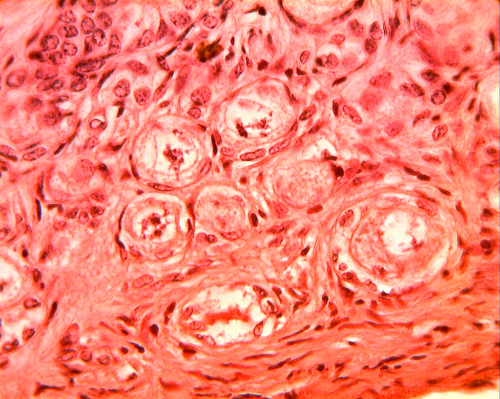 Follicules primordiaux (ovaire de lapine, microscope X600). Dans l'ovaire chaque ovocyte est entouré d'une enveloppe cellulaire plus ou moins développée, l'ensemble formant un follicule ovarien. Les <a href='https://phototheque.enseigne.ac-lyon.fr/photossql/photos.php?RollID=images&FrameID=follicules_primordiaux'><strong>follicules primordiaux</strong></a> sont constitués durant la période fœtale : une vingtaine de cellules aplaties entoure l'ovocyte. A partir de la puberté et à chaque cycle un certain nombre de follicules primordiaux se développent en <a href='https://phototheque.enseigne.ac-lyon.fr/photossql/photos.php?RollID=images&FrameID=follicule_primaire'><strong>follicules primaires</strong></a> : l'ovocyte grossit très légèrement et les cellules aplaties évoluent pour former des cellules cubiques, mais ne forment toujours qu'une seule couche. Dans le <a href='https://phototheque.enseigne.ac-lyon.fr/photossql/photos.php?RollID=images&FrameID=follicule_secondaire'><strong>follicule secondaire</strong></a>, l'ovocyte est entouré de plusieurs couches de cellules (voir aussi : <a href='https://phototheque.enseigne.ac-lyon.fr/photossql/photos.php?RollID=images&FrameID=follicules_primaire_et_secondaire'><strong>follicules primaire et secondaires côte à côte</strong></a>). Ensuite les cellules folliculaires entourant l'ovocyte deviennent cubiques, volumineuses et granuleuses : elles forment plusieurs couches cellulaires appelées granulosa. La granulosa se creuse de cavités remplies de liquide : c'est le stade <a href='https://phototheque.enseigne.ac-lyon.fr/photossql/photos.php?RollID=images&FrameID=follicule_cavitaire'><strong>follicule cavitaire</strong></a>. Le follicule mûr, ou <a href='https://phototheque.enseigne.ac-lyon.fr/photossql/photos.php?RollID=images&FrameID=follicule_De_Graaf'><strong>follicule de de Graaf</strong></a> est prêt à expulser l'ovocyte et les cellules qui l'entourent (la corona radiata). 