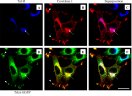 La microscopie confocale permet d'étudier la localisation de différentes protéines dans les cellules.  Des cellules PC12 (lignée tumorale dérivée de la crête neurale, chez le Rat) ont été transfectées pour exprimer la cavéoline 1 (protéine permettant de former des vésicules sur les membranes) et TrkA (récepteur du NGF=Nerve Growth Factor).  TrkA a la particularité d'être fusionné à la GFP (Green Fluorescent Protein), ce qui permet de le localiser par fluorescence verte.  La cavéoline 1 est détectée par un anticorps de lapin suivi d'un anticorps secondaire anti-lapin couplé à un fluorochrome rouge. Elle apparaît donc en rouge.  Le récepteur à la transferrine est détecté par un anticorps de souris suivi d'un anticorps secondaire anti-souris couplé à un fluorochrome bleu. Il apparaît donc en bleu.  Légendes: (A) Le marquage du compartiment endosomal par le récepteur à la transferrine (Tnf-R) apparaît en bleu. (B) Marquage de la cavéoline 1 en rouge. (C) Superposition des marquages Tnf-R et cavéoline 1 ; les zones de colocalisation apparaissent en rose. (D) Localisation subcellulaire de TrkA-GFP révélée par la fluorescence verte de la GFP. (E) Superposition des marquages TrkA-EGFP et cavéoline 1 ; les zones de colocalisation apparaissent en jaune. (F) Superposition des marquages Tnf-R, TrkA-GFP et cavéoline 1 ; les zones de colocalisation apparaissent en blanc. Barre = 5 micron.    <BR>  L'observation par microscopie confocale montre que la cavéoline 1 et TrkA-GFP sont très largement co-localisés à la fois à la surface cellulaire (pointe de flèche) et à l'intérieur de la cellule (flèche). Le compartiment intracellulaire où se co-localisent la cavéoline 1 et TrkA-GFP est également marqué par un anticorps dirigé contre le récepteur à la transferrine.  Le marquage périphérique correspond à des sites particuliers de la membrane plasmique, des filopodes enrichis en actine sous-membranaire. Le marquage intracellulaire correspond aux endosomes précoces et de recyclage, enrichis en récepteur à la transferrine. Des mouvements vésiculaires déplacent TrkA-EGFP entre ces deux localisations cellulaires.  On peut noter la présence de 2 cellules (en haut à droite) sans marquage Cavéoline 1. Ces deux cellules n'ont pas été transfectées par le vecteur d'expression de la protéine (la transfection d'une population de cellules n'est jamais efficace à 100%). [20483 views]