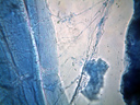 Fibres musculaires de grenouille, dilacérées et colorées au bleu de méthylène. La striation caractéristique des fibres musculaires squelettique est bien apparente. L’innervation des cellules musculaires est également mise en évidence. Les fibres nerveuses forment un faisceau qui se projette sur les fibres musculaires, avec par endroit des zones de contact plus densément colorées qui pourraient être des plaques motrices. Il s’agirait donc de l’extrémité des motoneurones. [2128 views]