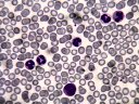 Cellules sanguines humaines. Outre les hématies, quelques   leucocytes sont visibles ici : 4 granulocytes et un monocyte. [29871 views]