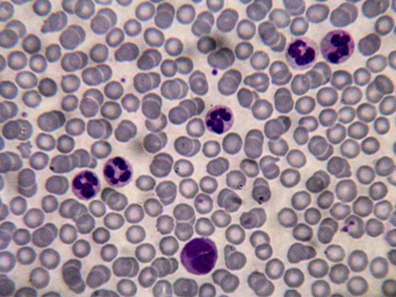 Cellules sanguines humaines. Outre les hématies, quelques   leucocytes sont visibles ici : 4 granulocytes et un monocyte.
