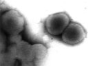 Liposomes de lécithine au microscope électronique à transmission (x 60 000). On observe des structures sphériques constituées d'un empilement de feuillets lipidiques analogues à ceux des membranes plasmiques. Les liposomes ont été obtenus après 15 minutes d'agitation magnétique modérée d'une solution de lécithine à 1% dans l'eau distillée. [26401 views]