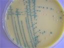 Etalement de <em>Listeria spp.</em> sur de la gélose ALOA (Agar Listeria selon Ottaviani et Agosti). La gélose ALOA est utilisée en analyses alimentaires ou pour tout autre type de prélèvement. Ce milieu est destiné à l'isolement et au dénombrement des <em>Listeria spp.</em>. Sur ce milieu, les <em>Listeria</em> forment des colonies rondes, régulières, de couleur bleue (détection de la bêtaglucosidase grâce à un substrat chromogénique spécifique). [26498 views]