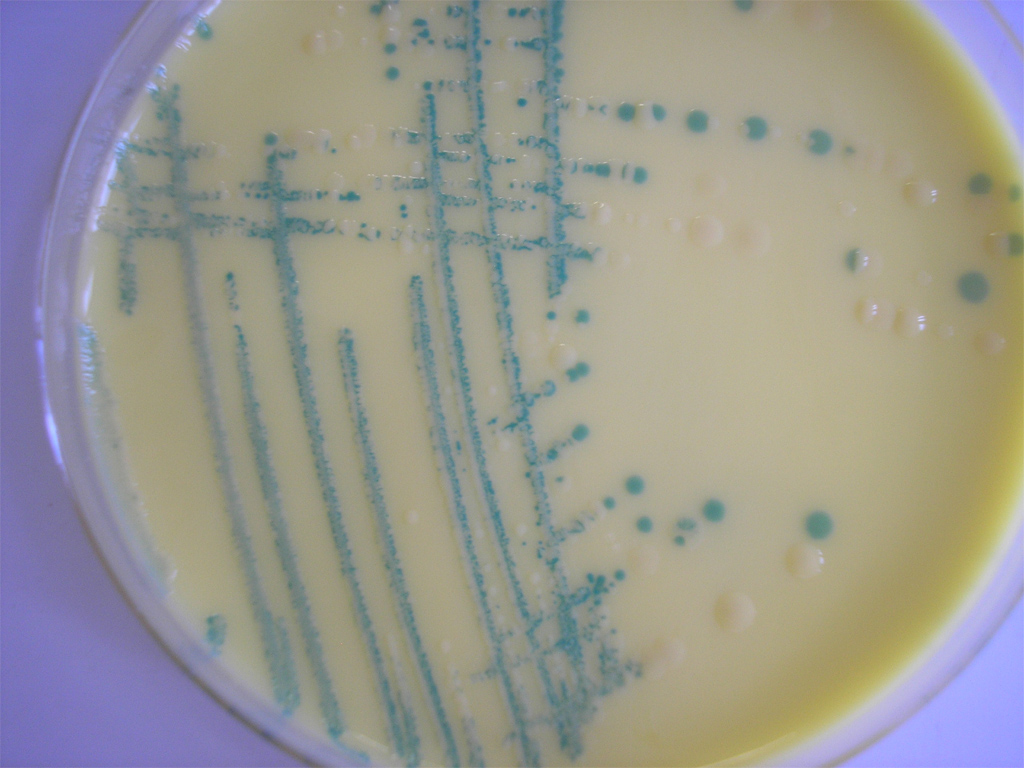Etalement de <em>Listeria spp.</em> sur de la gélose ALOA (Agar Listeria selon Ottaviani et Agosti). La gélose ALOA est utilisée en analyses alimentaires ou pour tout autre type de prélèvement. Ce milieu est destiné à l'isolement et au dénombrement des <em>Listeria spp.</em>. Sur ce milieu, les <em>Listeria</em> forment des colonies rondes, régulières, de couleur bleue (détection de la bêtaglucosidase grâce à un substrat chromogénique spécifique).