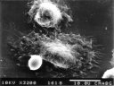 Photo de microscopie électronique à balayage montrant deux macrophages de souris et une levure (<em>Saccharomyces cerevisiae</em>). Pour obtenir les macrophages, on a injecté des billes de biogel en sous-cutané à une souris. Il y a formation d'un granulome = réaction immunologique peu intense, les macrophages se rassemblent temporairement autour du matériau inerte qu'ils ne phagocytent pas. Ensuite on dissèque la peau et on récupère le granulome à partir duquel on purifie les macrophages. On dépose les cellules sur une lamelle et on ajoute des levures, ce qui entraîne une activité de phagocytose (cf <a href='https://phototheque.enseigne.ac-lyon.fr/photossql/photos.php?RollID=images&FrameID=macrophage_levures2'>photo suivante</a>). [34057 views]