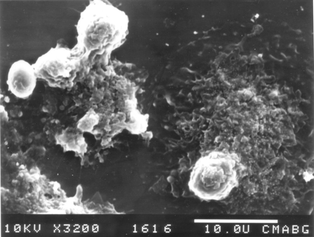 Photo de microscopie électronique à balayage montrant des macrophages de souris et des levures (<em>Saccharomyces cerevisiae</em>). On voit une levure opsonisée, et on devine la forme de trois levures déjà phagocytées par les macrophages.