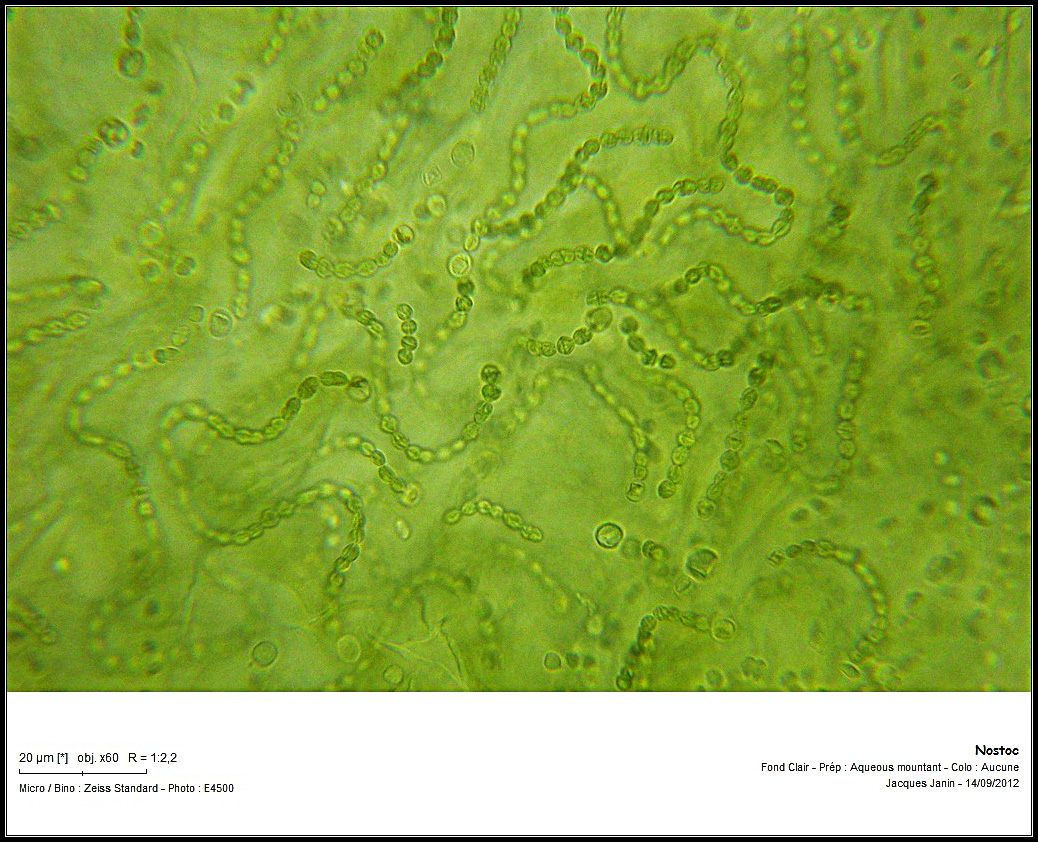 Cyanobactérie du genre <em>Nostoc</em>, communément appelée <a href='https://phototheque.enseigne.ac-lyon.fr/photossql/photos.php?RollID=images&FrameID=nostoc'>Crachat de Lune</a>.