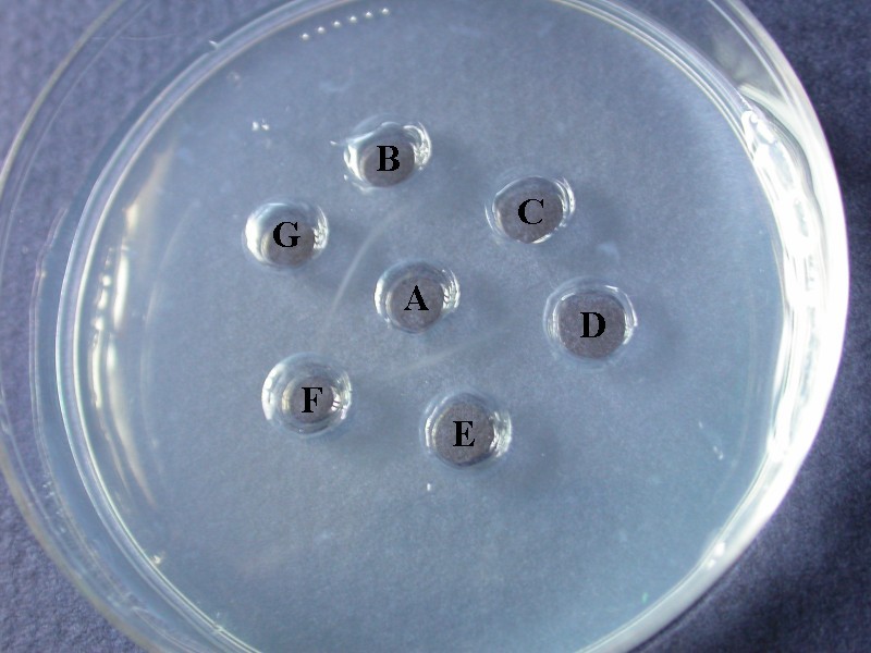 Test d'Ouchterlony.
<br />Le puits central (A) contient du sérum de lapin immunisé contre la BSA (Bovine serum albumin).
<br />Les autres puits contiennent respectivement du sérum de chèvre (B), de porc (C), de lapin (D), de boeuf (E), de cheval (F) et une solution de BSA (G).
<br />On constate la formation d'un arc de précipitation, qui correspond à la formation de complexes immuns, entre le puits central et les puits E et G.
<br /><a href='http://svt.enseigne.ac-lyon.fr/spip/spip.php?article196' target='_blank'>Voir la technique</a>