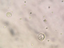 Ovules et spermatozoïdes de moule d'Espagne (<em>Mytilus galloprovincialis</em>). Chez la moule les sexes sont séparés. Une moule peut produire chaque année 5 à 12 millions d'œufs, en plusieurs fois. La ponte a généralement lieu de mars à octobre mais peut être déclenchée par des variations de température ou de quantité de nourriture. La fécondation a lieu dans l'eau. Voir le <a href='http://svt.enseigne.ac-lyon.fr/spip/spip.php?article35'>protocole de préparation et d'observation</a>. [23200 views]