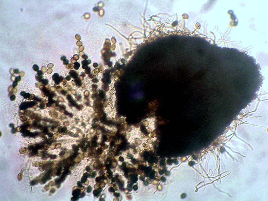 Mycélium, périthèce mûr éclaté et bouquet d'asques chez <em>Sordaria</em>.