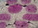 Cellules d'épiderme d'oignon rouge plasmolysées. [32460 views]