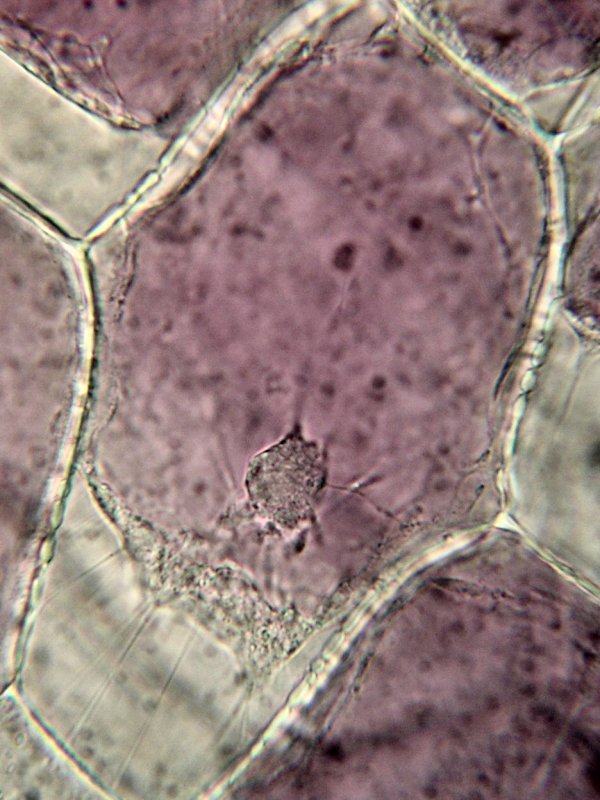 Cellules d'épiderme d'oignon rouge plasmolysées.