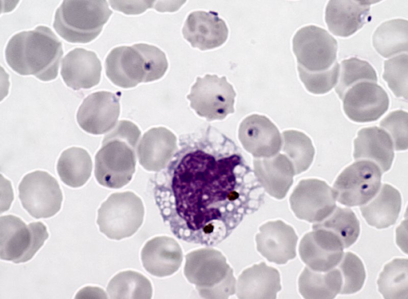 Le paludisme (<em>Plasmodium falciparum</em>, Protozoaires) : macrophage humain. Microscopie optique, coloration au MGG (May Gründval Giemsa).